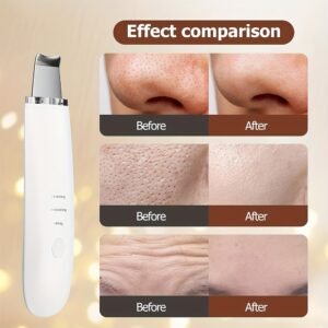 Skin Scrubber Ultrasónico 3 en 1 para Limpieza Facial con kit Sacacomedones de Acero - Imagen 3